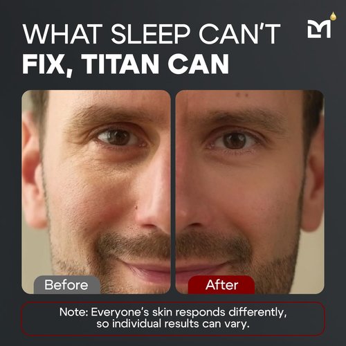 Man Labs Titan Men's Eye Cream - Anti-Aging Treatment for Dark Circles & Eye Bags - Peptides & HA - Unscented
