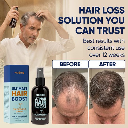 Moerie Hair Growth Serum Spray - Biotin & Rosemary Formula for Thinning Hair | Scalp Care Solution