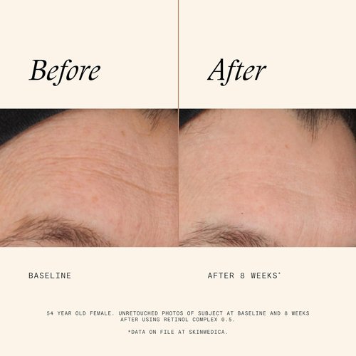 SkinMedica Retinol 0.5 Complex - Age-Defying Serum That Renews Skin & Reduces Fine Lines - 1 Fl Oz