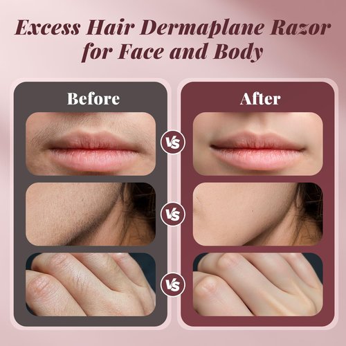 Dermaplane Razor for Women Face, BNU Facial Hair Remover for Anti-Aging - Rechargeable - LED Light - Sonic Edges - 3 Speeds, Ergonomic Handle Face Dermaplaning Tool 10 Weeks, Pink