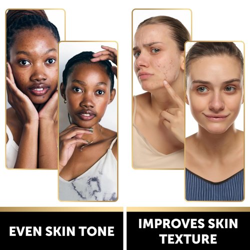 VALITIC Snail Mucin Cleanser Soap Bar - Turmeric & Kojic Acid Dark Spot Corrector | Anti-Aging Hydration - 2 Pack