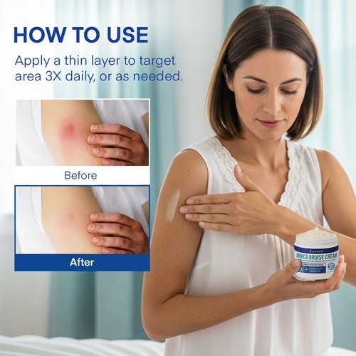 Arnica Bruise Cream Extra-Strength: Fast-Acting for Bruising & Swelling on Thin Skin - Advanced Formula with Arnica Montana Vitamin K C & E - Soothing Hydrating for Face and Body (4 Fl Oz (Pack of 1))