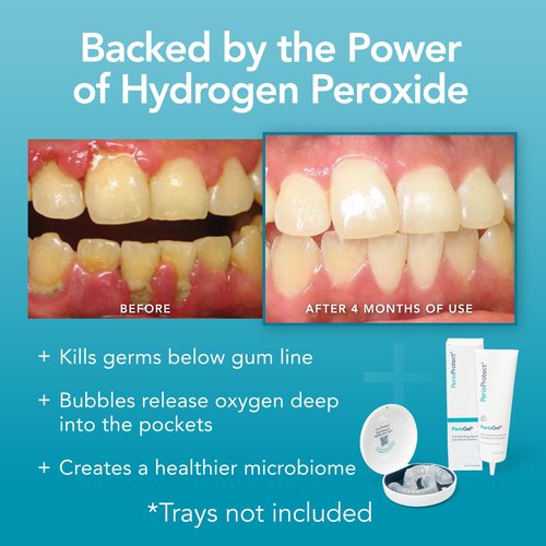 Perio Gel | Periodontal Treatment for Teeth | Promotes Teeth Whitening (3 oz.)