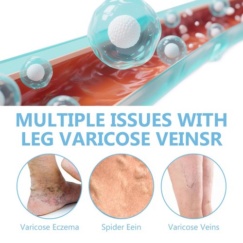 ITECFREELY Varicose Veins Cream, Improve Blood Circulation Varicose Veins Care, Fast Soothe Cream for Legs