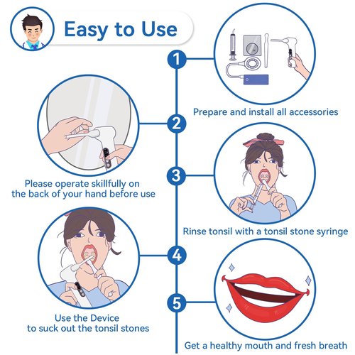 Sinkawa Upgraded Electronic Tonsil Stone Remover，10 in 1 Tonsil Stone Removal Kit，Tonsil Stone Vacuum with Built-in Blue Light，Easy to Use, Fight Bad Breath, Instant Suction