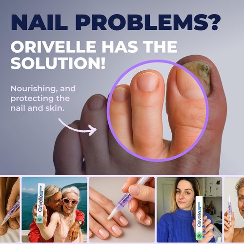 Orivelle Nail Fungus Pen – Professional Nail Repair & Strengthening Solution with Tea Tree Oil – Improves Appearance of Discolored or Damaged Nails (Pack of 2)