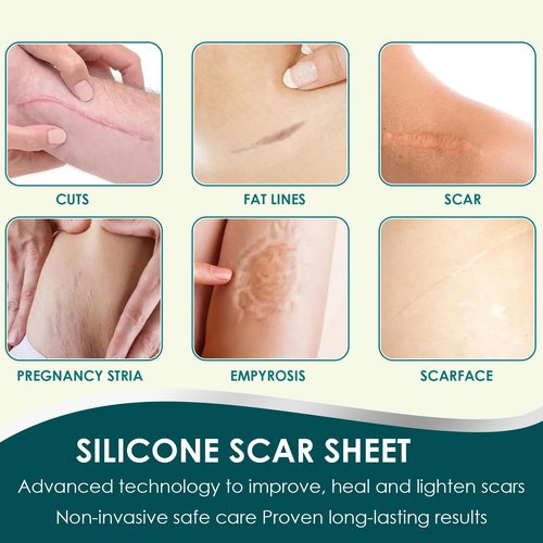 Silicone Scar Tape (1.6"x 120" Roll-3M), Premium Silicone Gel Scar Sheets, Reusable Silicone Patches, Soft Silicone Tape for Surgeries Scars, C-Sections, Wrinkles et