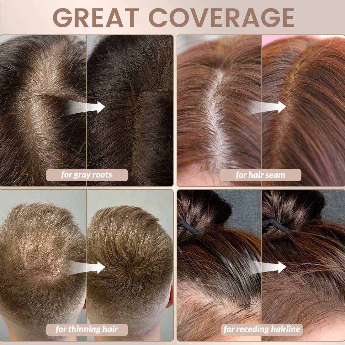 VOLLUCK Root Touch Up Hair Color Spray - Ammonia-Free, Quick Drying Grey Coverage for Men & Women | Black