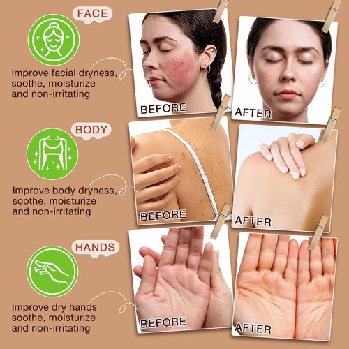 asusxcli Beef Tallow for Skin,Beef Tallow for Face,Beef Tallow and Honey Balm,Grass Fed Whipped Tallow Honey Balm,Natural Moisturizer Hydrates,Deeply Nourishes the Skin, Enhances Natural Radiance