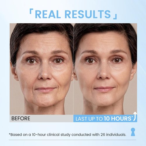 RONKIE Instant Eye Face Lift Cream: Reduces Eye Bags Wrinkles Puffy Eyes Dark Circles Crow’s Feet in Minutes for Mature Skin of Middle-aged Women 1 Fl Oz