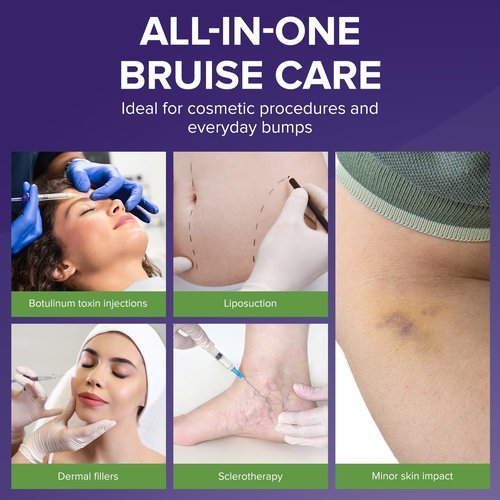 BIOCORNEUM Advanced Bruise Cream 1oz – Professional-Grade Arnica & Vitamin K Cream for Visible Skin Recovery – Botanical Formula with Vitamin E, Green Tea Extract & More – Lightweight, Fast-Absorbing