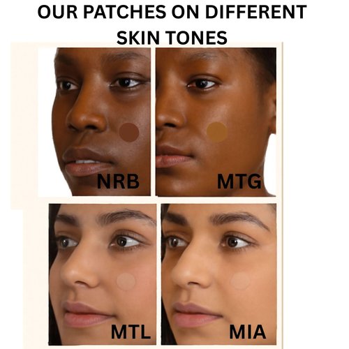 MATCHED Hydrocolloid Pimple Patches-Invisible Acne Patches for Face, 3 Sizes, 72-Count (1 Pack),Zit patches that match Skin tone for Daytime Use, for proactive acne treatment (NRB)