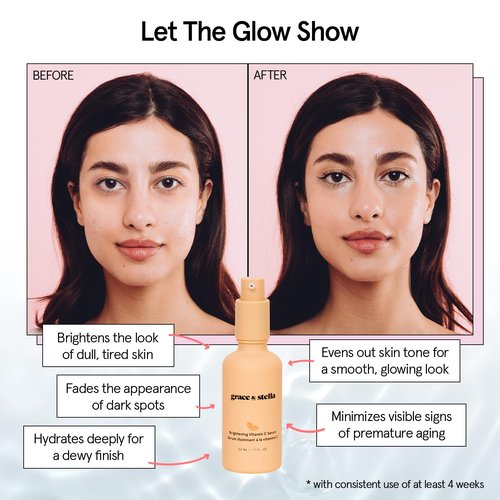 Grace & Stella Vitamin C Serum - Brightening Face Serum with Hyaluronic Acid | 50ml for Dullness & Dark Spots