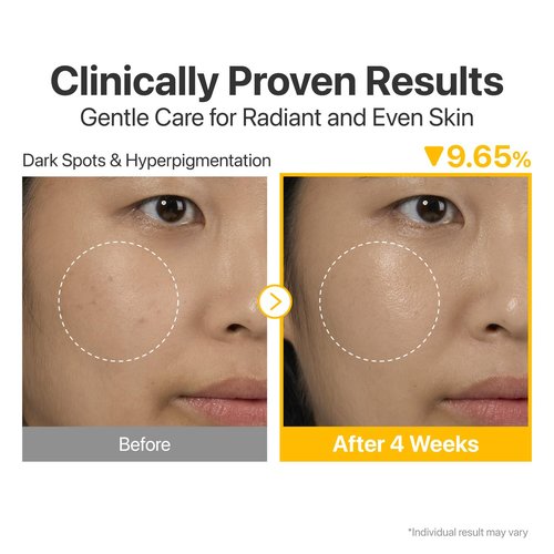 numbuzin No.5 Serum | Glutathione Vitamin Concentrated Serum 30ml Travel Set (+1ml*10ea) | Glutathione, Vitamin C, Tranexamic Acid | Hyperpigmentation, Acne Scars, Korean Skincare | 1.31 fl. oz.