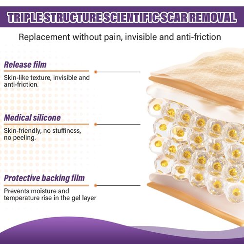 Silicone Scar Sheets,Silicone Scar Tape,Silicone Scar Removal Strips for Surgical,C-Section,Tummy Tuck,Keloid Scars (1.6"X 157" Roll-4M) Keloid Bump Removal