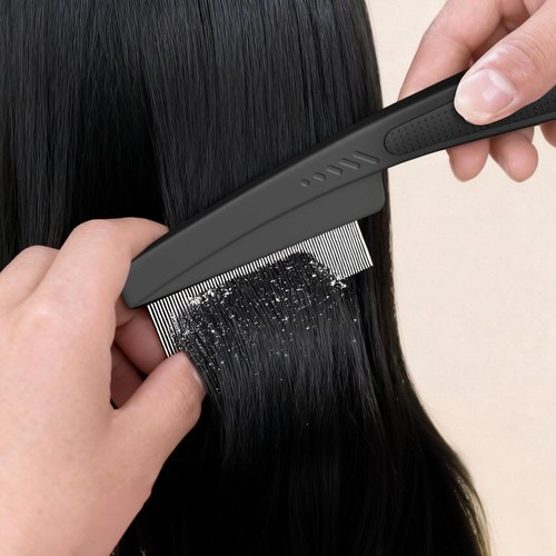 Dandruff Comb | Stainless Steel Fine Tooth Scalp Detox Tool for Women, Men & Kids - Black & Orange