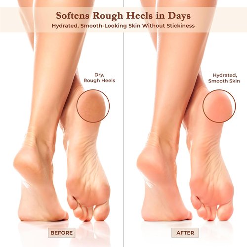 Regine Switzerland Foot Cream - Hydrating Moisturizer with Argan Oil & Shea Butter for Dry Cracked Heels | Fast-Absorbing, Non-Sticky Care
