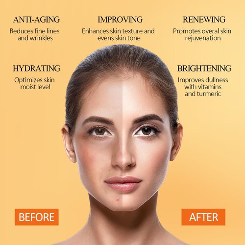 SHVYOG Turmeric Vitamin C Clay Mask with Kaolin Clay for Dull & Blemish-Prone Skin, Deep Cleansing Facial Mask, Face Masks Skincare for Controlling Oil and Refining Pores 5.29 Oz 150g