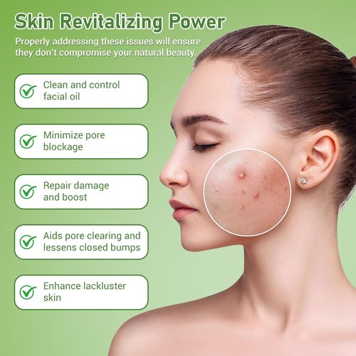 Eofot 14% Azelaic Acid Acne Cream, Azelaic Acid For Face, Helps Improve the Appearance of Acnes - Azalecic Acids Acido Azelaico, 1 Fl Oz