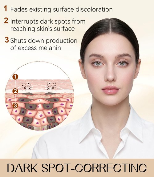 Dark Spot Remover for Face & Body, Dark Spot Corrector with Niacinamide, Fade Cream for Hyperpigmentation, Sun Spots, Age Spots & Melasma, 1.7 fl oz, Skincare Gift for Women, Women’s Day Gift