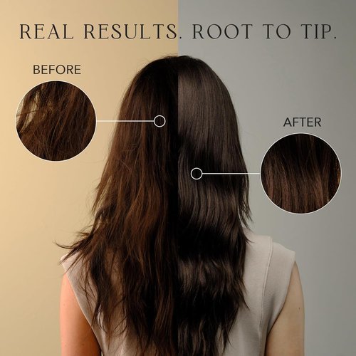 Kiwabi Root Beauté Itchy Scalp Shampoo - Sulfate-Free Natural Treatment for Dry & Oily Scalps | 23 Botanicals for Hair Growth