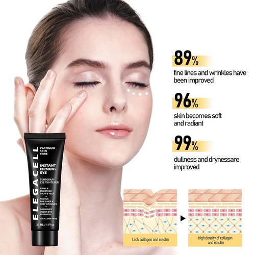 Skiennix Instant Eye Tightener Cream - Reduces Puffiness & Wrinkles, Lightweight Formula, 1 Fl oz / 30ml