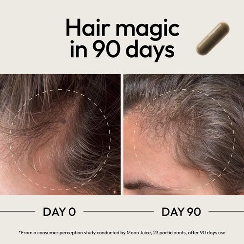 Moon Juice SuperHair Hair Growth Vitamins - Clinical Strength Biotin & Saw Palmetto Supplement for Thicker Hair | 120 Capsules