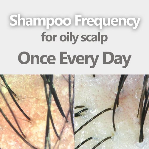 Aromase Oily Scalp Balancing Shampoo - Dandruff Control for Oily Scalps | 14 FL OZ