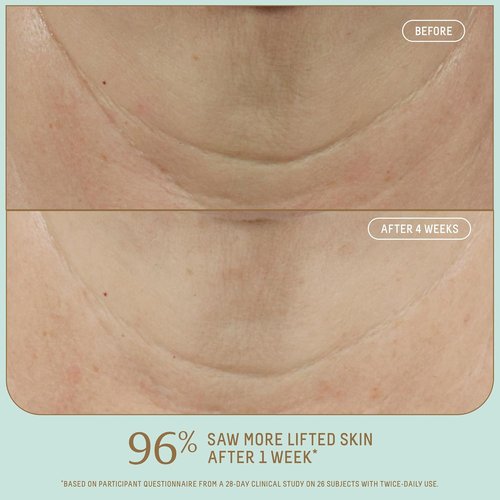 Biossance Squalane + Firm & Lift Dual Serum - Anti-Aging Face Serum for Maturing Skin - 30ml
