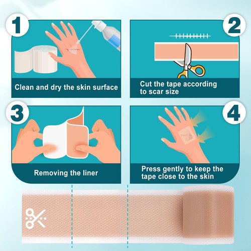 Aheroi Silicone Scar Tape, 1.6"x200" Silicone Scar Sheets(2 Rolls-5M)Medical Grade Scar Sheets for Surgical Scars, Soft Scar Patches Reusable Scar Removal Strips,Effective C-Section Keloid Tummy Treat