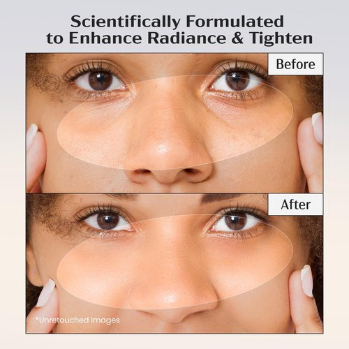 Lanmeri Ceuticals 15% Vitamin C + E + Ferulic Serum: Advanced Antioxidant Defense Formula with 1% Vitamin E & 0.5% Ferulic Acid – High-Stability Vitamin C Serum (1 fl oz)