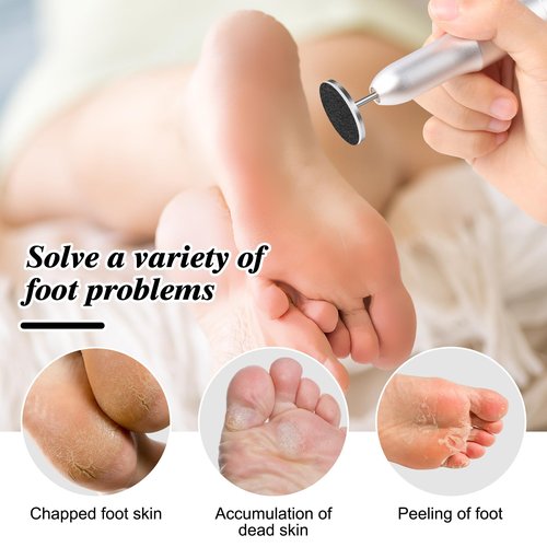 BELICOO 120 Pcs Sanding Paper Disc w/ 2 Metal Bit, 80/120/180/240 Grit Round Pedicure Replacement Sanding Discs for Electric Nail File Bits, Foot File Sandpaper Discs for Dead Skin Foot Callus Remover