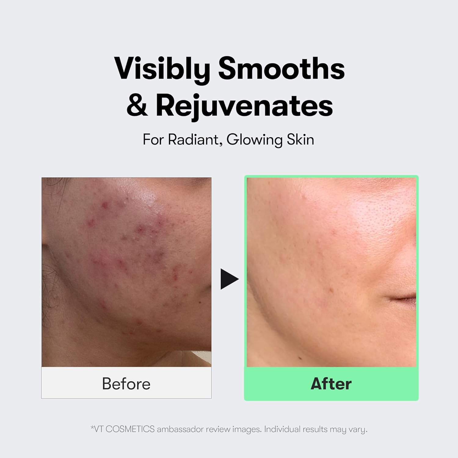 VT COSMETICS CICA Reedle Shot Serum - Microneedling Exosome Formula for Pore Care & Glass Skin (1.69 Fl Oz)