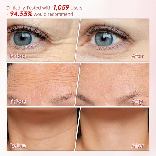 Peunitory Eye Balm Stick - Anti-Wrinkle Under Eye Cream | Dark Circle Brightener | Hydrating (0.32oz)