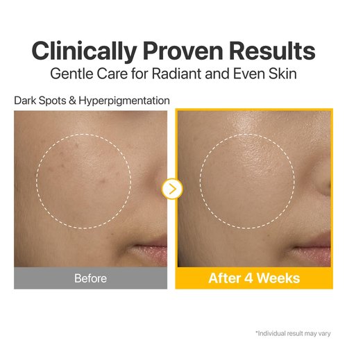 Numbuzin No.5 Vitamin Serum - Dark Spot Care with Glutathione & Tranexamic Acid | 1.01 fl oz for Radiant Skin