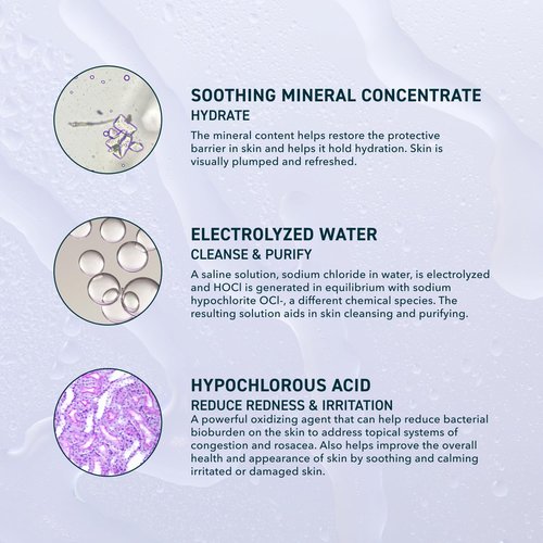 Prequel Skin Universal Skin Solution Hypochlorous Acid Spray for Face and Body. Fine Mist HOCL Facial Cleanser and Dermal Spray with Minerals & Electrolyzed Water - pH-Stabilized Care. 4oz