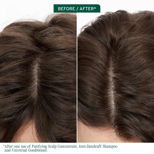 Biolage Scalp Sync Purifying Concentrate - Exfoliating Dry Scalp Treatment with Fermented Tea & Glycolic Acid