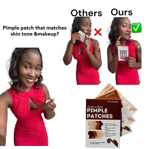 MATCHED Hydrocolloid Pimple Patches-Invisible Acne Patches for Face, 3 Sizes, 72-Count (1 Pack),Zit patches that match Skin tone for Daytime Use, for proactive acne treatment (NRB)