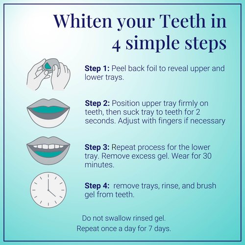 Everest VAAS Prefilled Teeth Whitening Trays, 7-Day at-Home Teeth Whitening Kit with 11.2% Hydrogen Peroxide, 14 Disposable Mint-Filled Trays