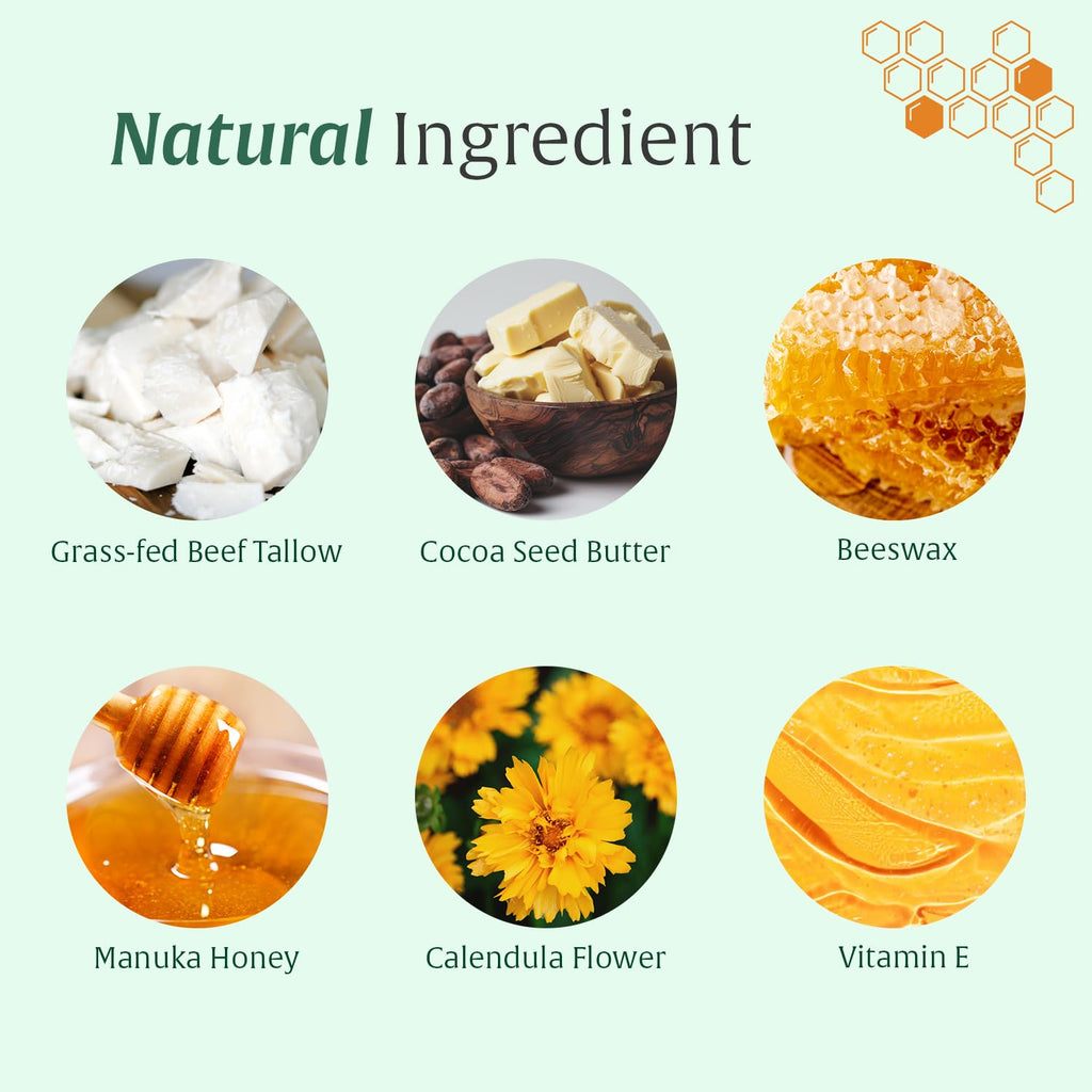Whipped Honey Tallow Balm for Skin – 100% Grass-Fed beef Tallow, Manuka Honey, Body Butter, Dry Skin Cream, Natural Moisturizing Cream for Dry, Sensitive Skin, Eczema & Body Care, 4 oz