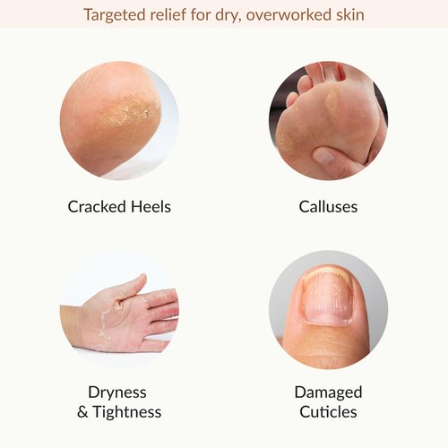 Epielle Hydrating & Moisturizing Hand & Foot Masks, Relieve and Soften Dry, Rough Skin, Self Care Gifts for Women, Spa Kit, Easter Basket Stuffers, 6 Moisturizing Gloves & 6 Moisturizing Socks