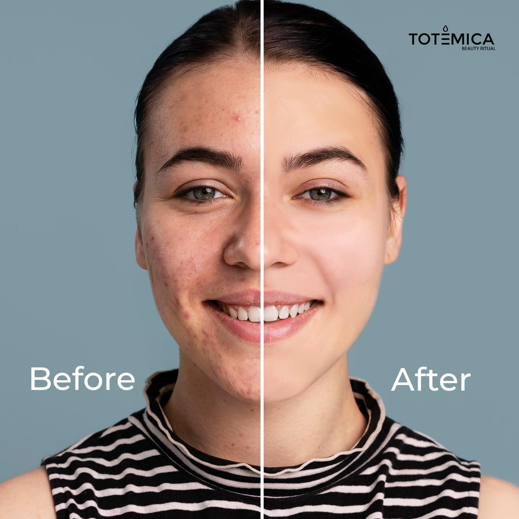 TOTEMICA Face Moisturizer - Anti-Aging Serum with Niacinamide & Hyaluronic Acid | Vegan & Cruelty-Free (1.69 Fl Oz)