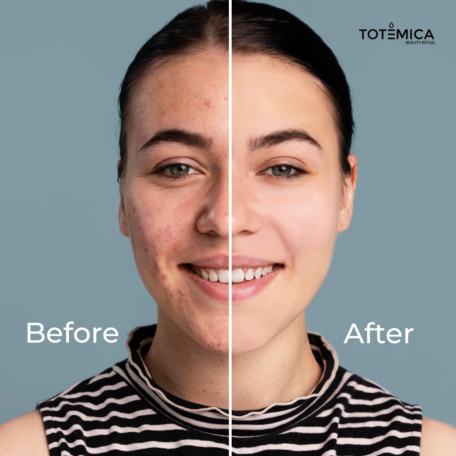 TOTEMICA Face Moisturizer - Anti-Aging Serum with Niacinamide & Hyaluronic Acid | Vegan & Cruelty-Free (1.69 Fl Oz)
