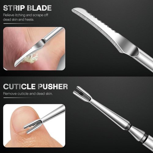 6PCS Ingrown Toenail Treatment Set, Professional Pedicure Tools for Feet, Ingrown Toenail Removal Kit with Leather Case Foot Nail Care Tools Manicure Set for Ingrown Toenails Calluses Corn & Dead Skin