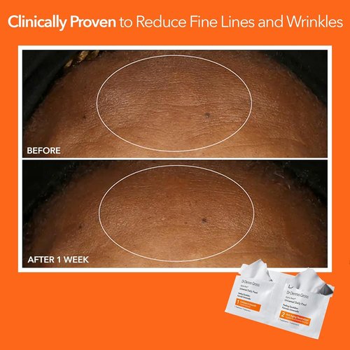 Dr. Dennis Gross Alpha Beta Daily Peel - Smooth Uneven Tone & Texture | 5 Treatments for Fine Lines