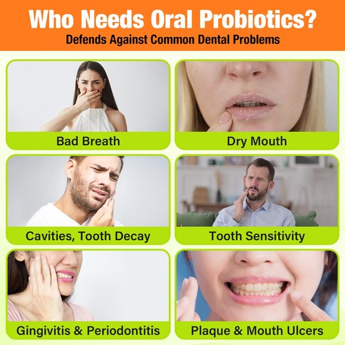 Oral Probiotics for Mouth Bad Breath Treatment for Adults, 50 Billion CFU, 19-in-1 Advanced Dental Probiotic for Teeth & Gum Restore, Fresh Breath, Dry Mouth, Gut & Overall Health - 120 Tablets