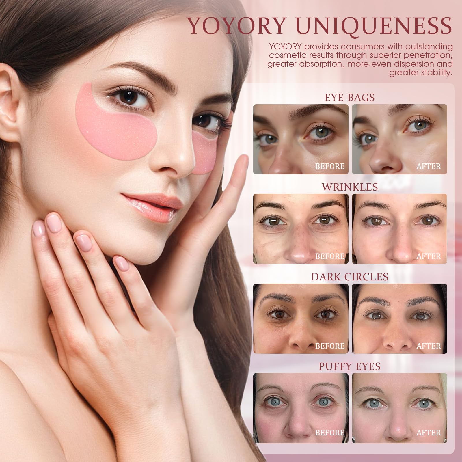 YOYORY Under Eye Patches for Dark Circles and Puffiness, 60 Pcs Collagen Eye Masks for Eye Bags, Fine Lines & Wrinkles, Eye Treatment with Hyaluronic Acid for Hydrating & Moisturizing, Pink