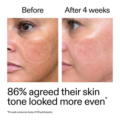 The INKEY List Starter Dual Retinol Serum 1 Fl Oz, 0.5% Amisol Trio & 0.2% Symrelief, Gentle Skin Renewal, Smooths Fine Lines, Hydration & Barrier Protection, Suitable for Sensitive Skin