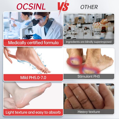 OCSINL Urea Cream 40 Percent for Feet Maximum Strength, with Heel Protectors, Foot Moisturizer Cream for Dry Cracked Heels Rough Dead Dry Skin Foot Callus Remover - 5.29 Oz