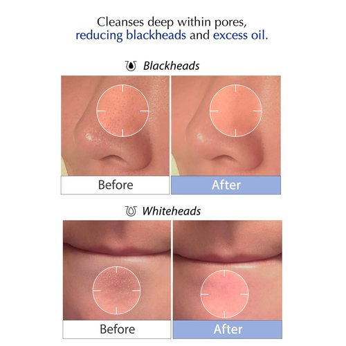 MSM Sulfur Deep Pore Cleanser - Gentle Low pH Face Wash for Sensitive Skin | Pore Reset Formula